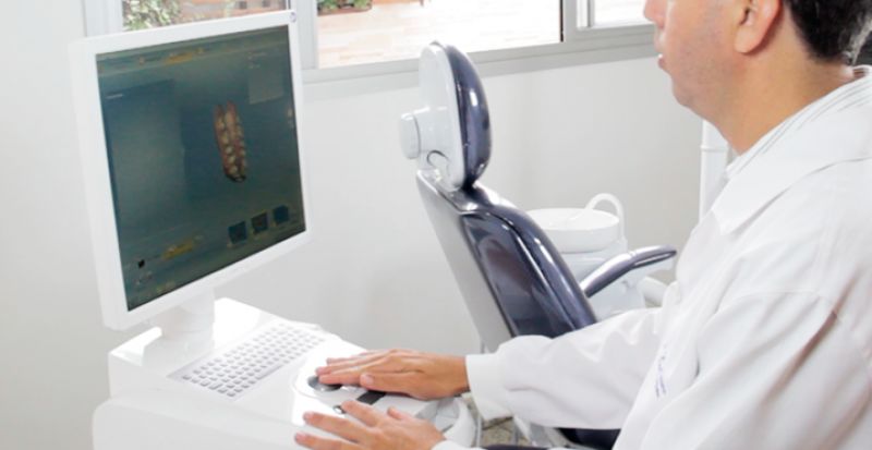 CEREC OMNICAM - O sistema mais utilizado do mundo!