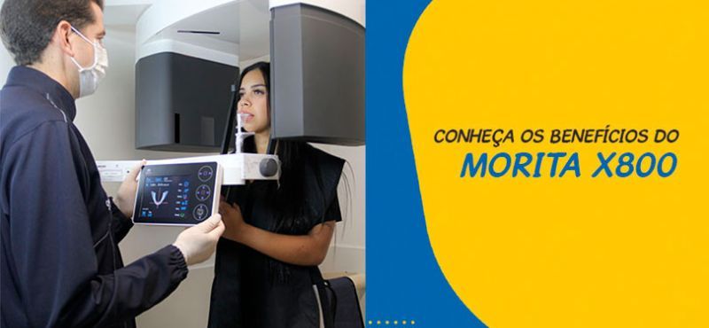 Morita X800, a melhor resolução de imagens do mundo!