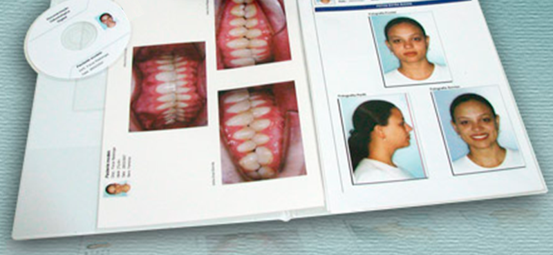 Documentações Ortodônticas 