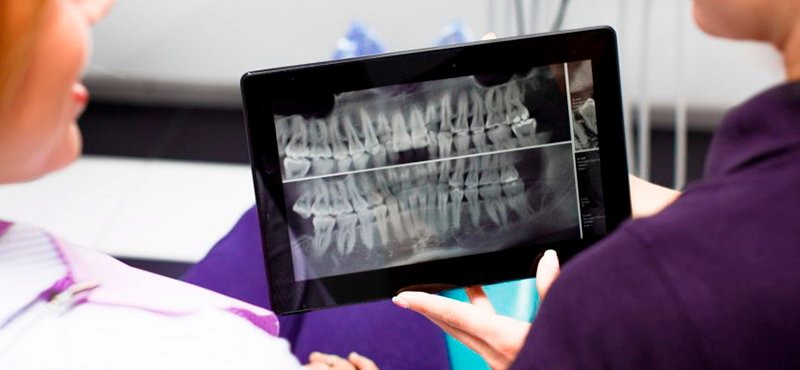  Periapical e Interproximal Digital 