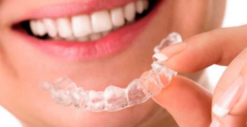 Documentação para alinhadores ortodônticos