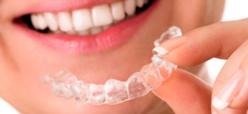 Documentação para alinhadores ortodônticos