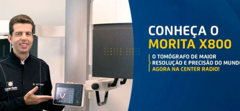 TOMOGRAFIA COM MORITA  X800